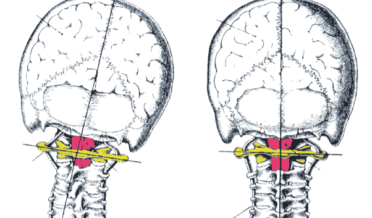 The Brain and Nervous System How It Controls Your Health